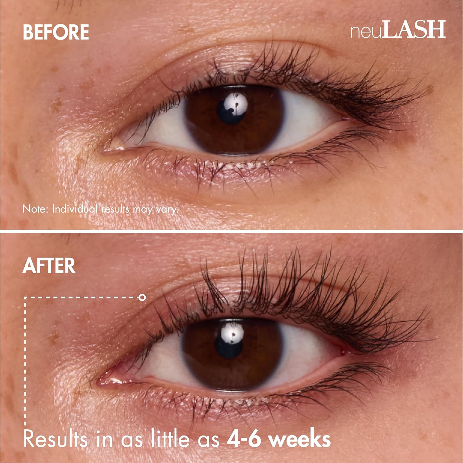 Eye Lash Enhancing Serum for Thicker, Longer Looking Lashes - neuLASH Eyelash Serum by Skin Research Laboratories - Advanced Formula Improves the Look of Natural Lash Follicles & Healthy Lash Lines
